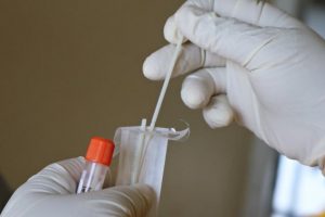 PCR test payments to end